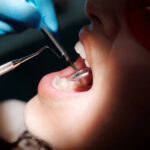Implanty Kielce: Nowoczesne rozwiązanie dla odbudowy zębów